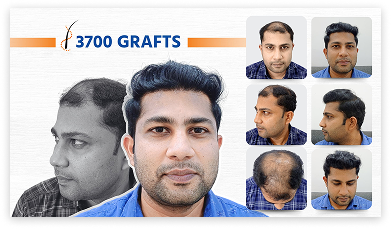 Patient before and after 2